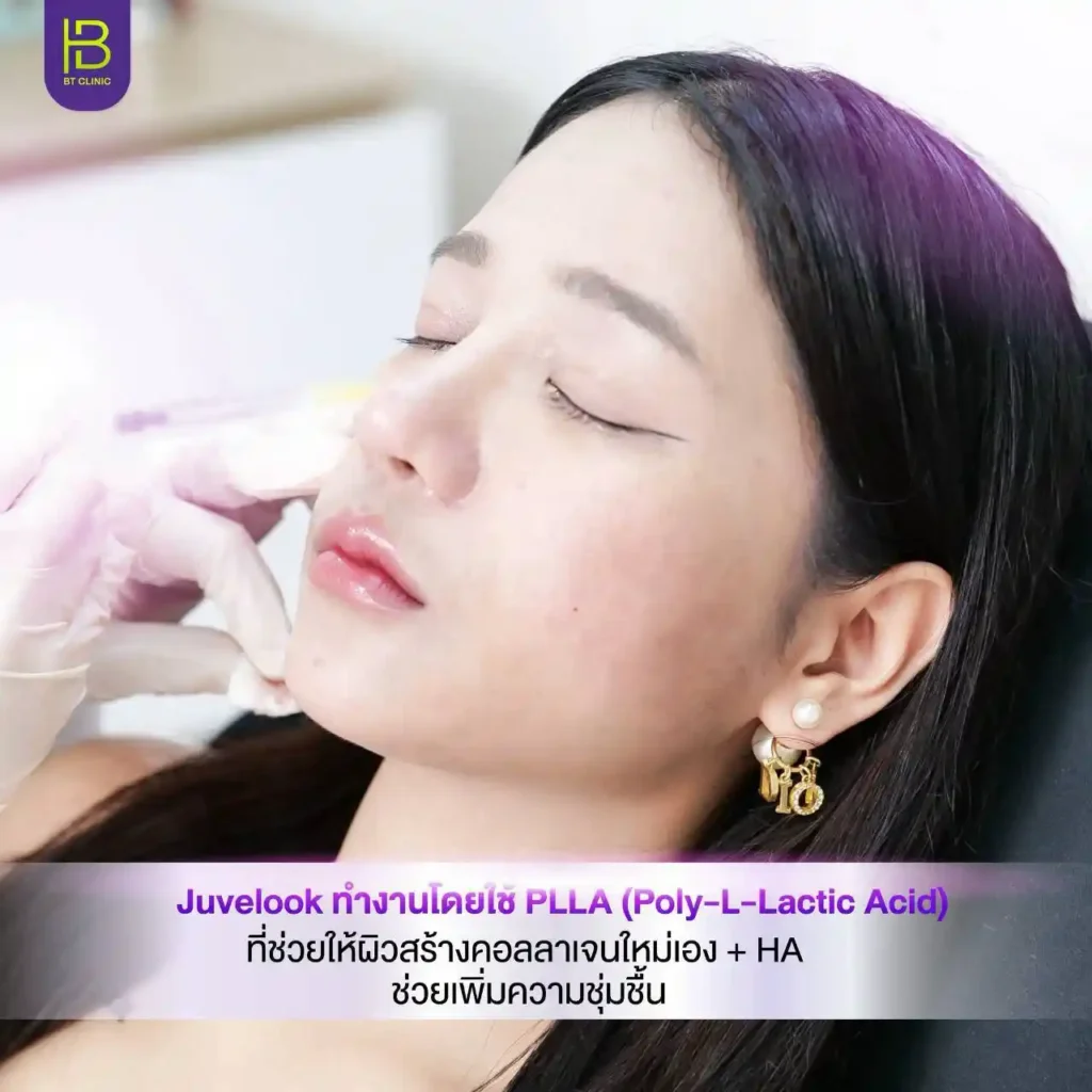 รูปรีวิว 182