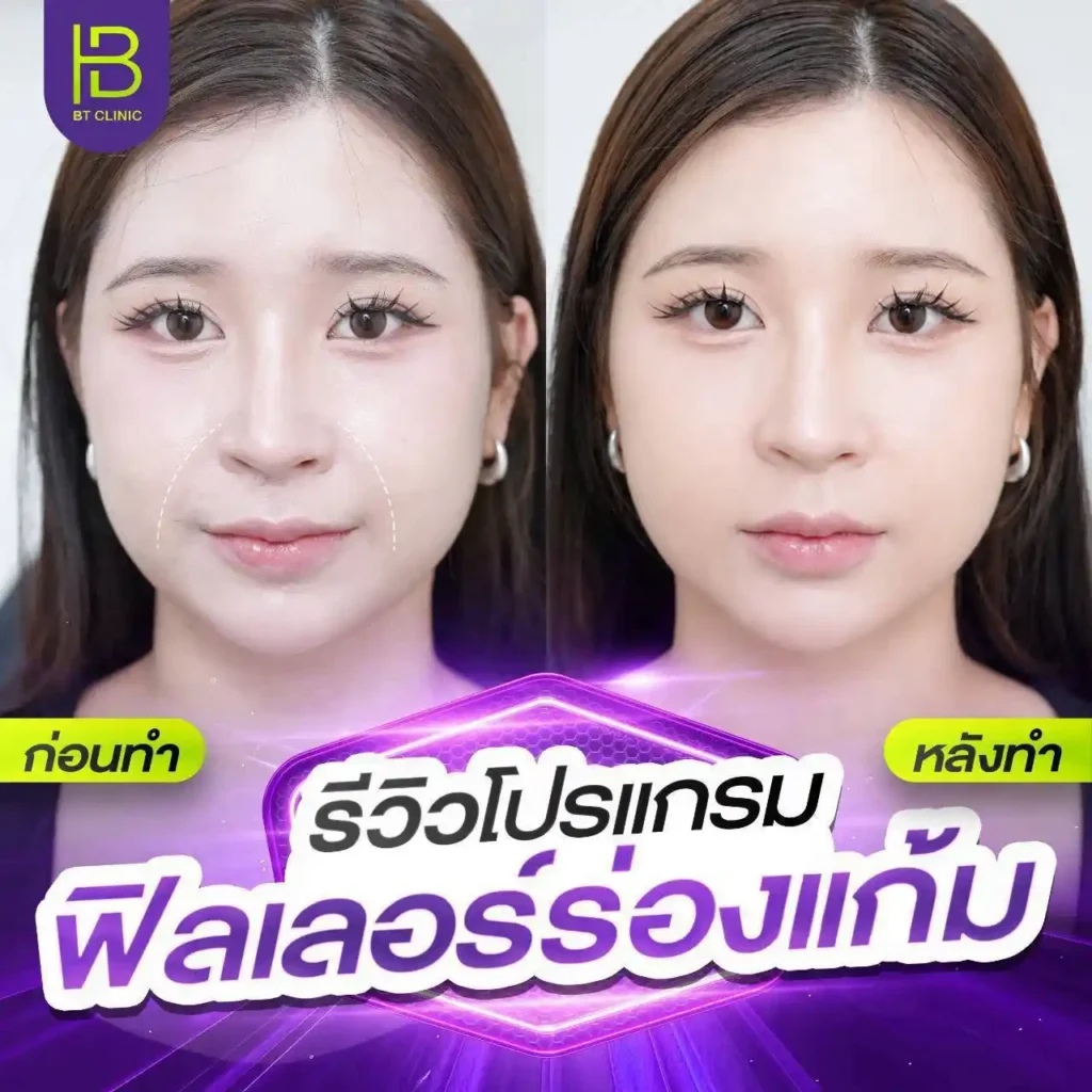 รูปรีวิว 190
