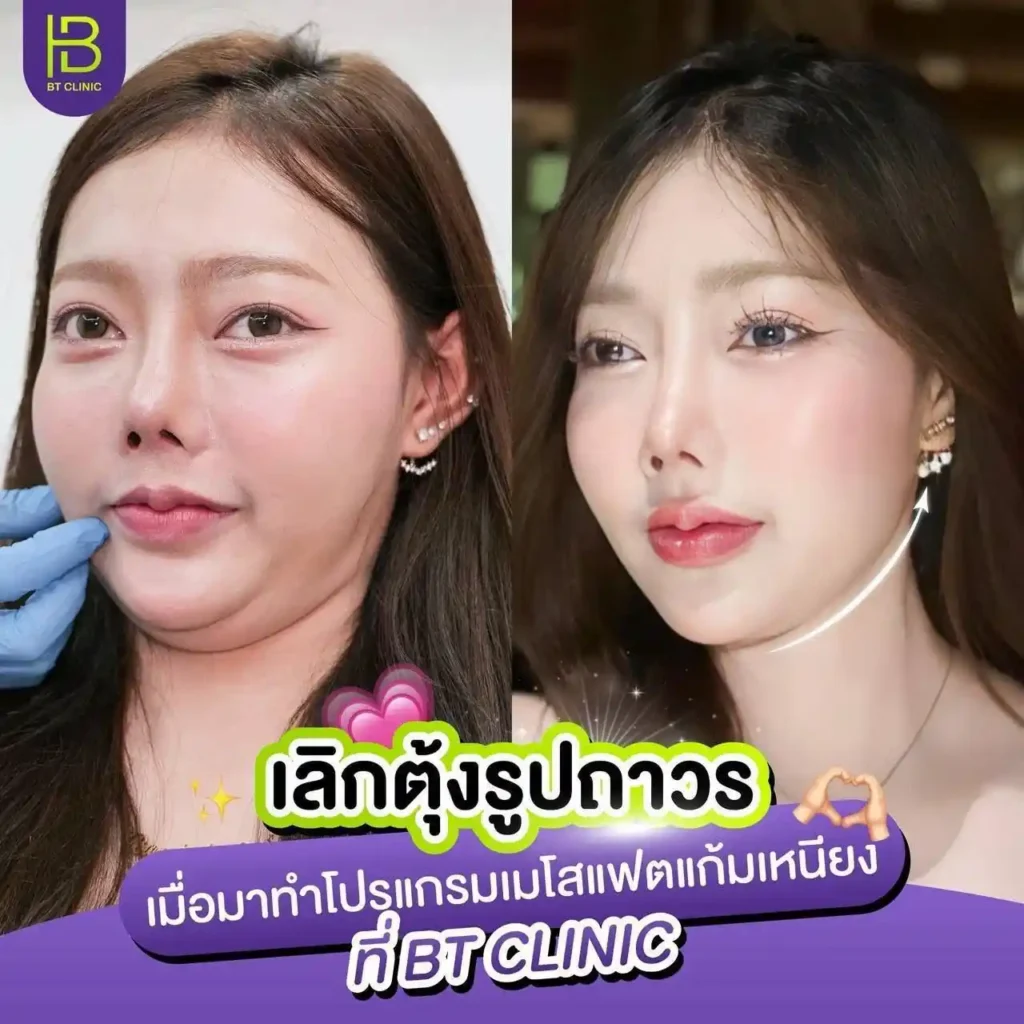รูปรีวิว 191