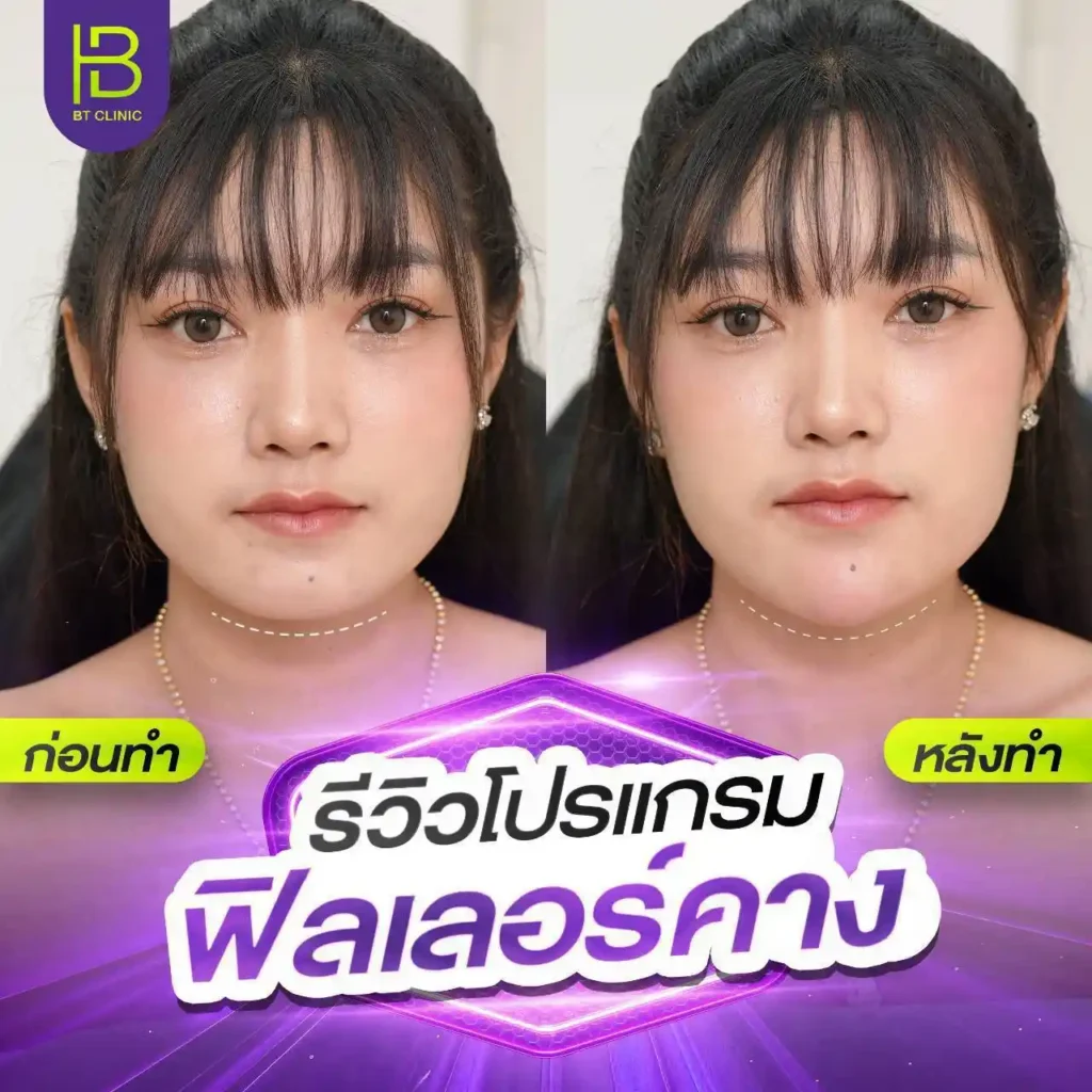 รูปรีวิว 192