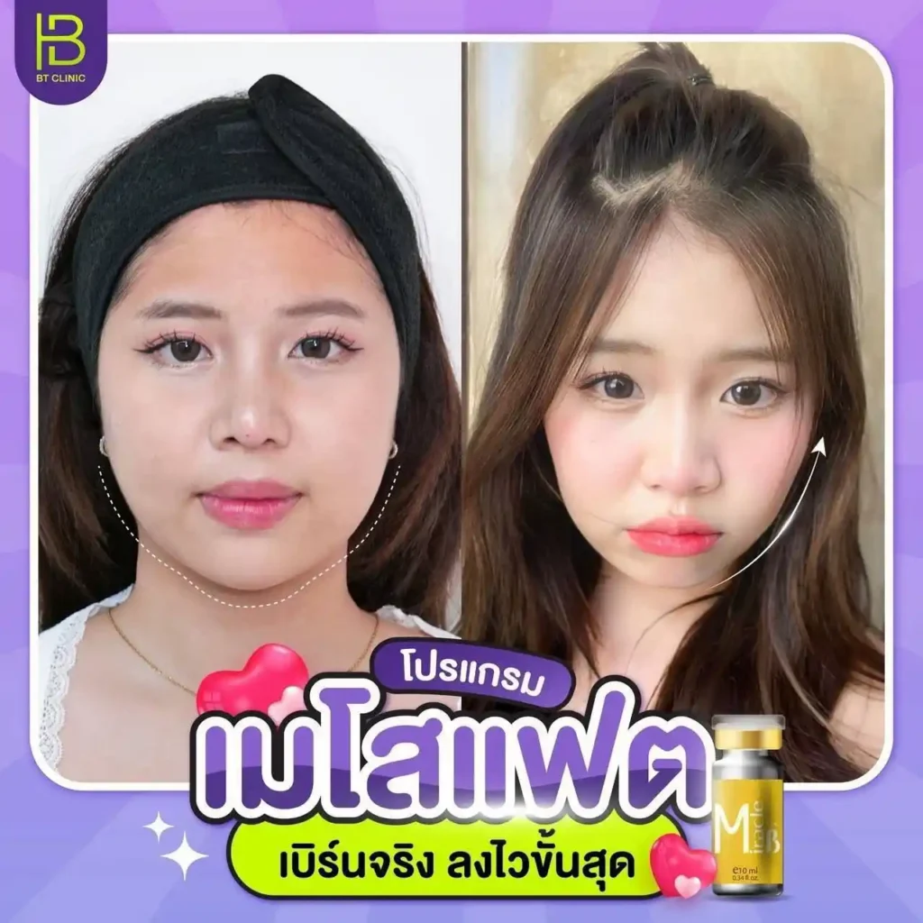 รูปรีวิว 193
