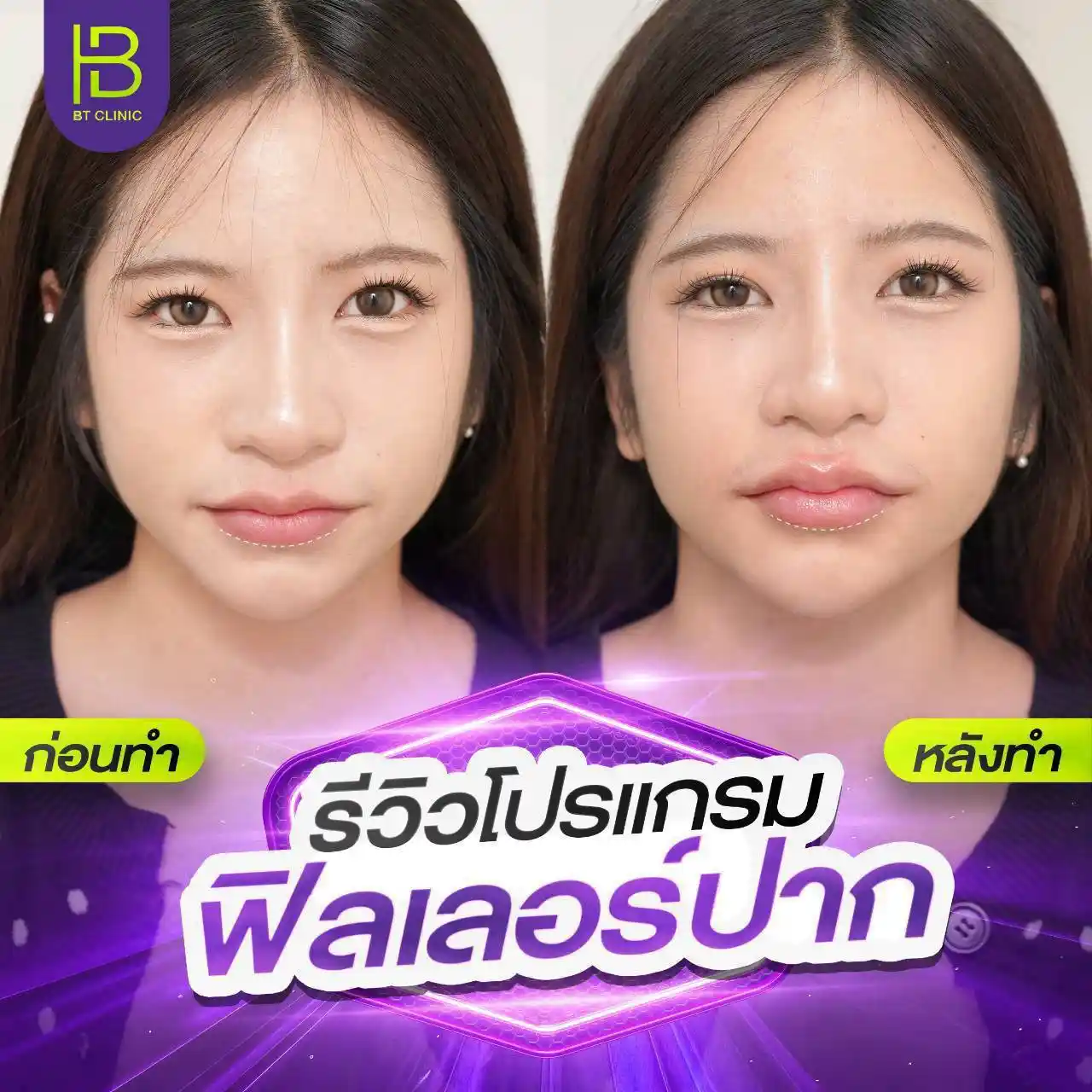 รูปรีวิว 194
