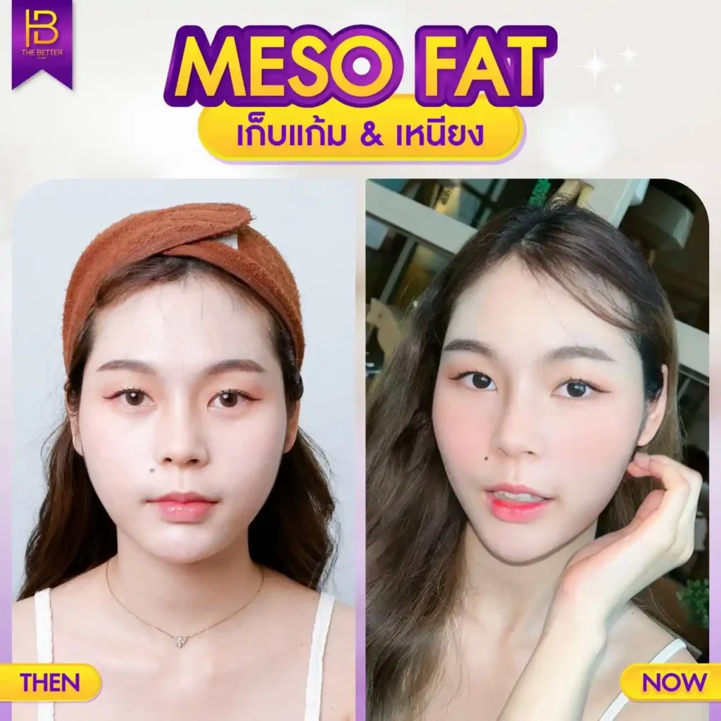 รูปรีวิว 195