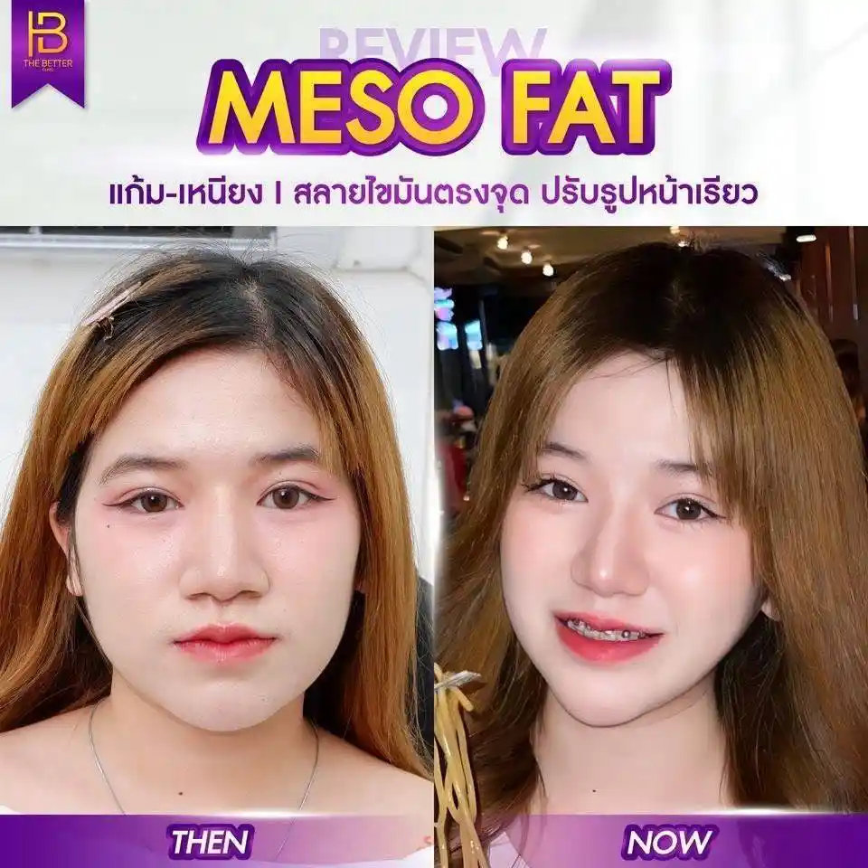 รูปรีวิว 196