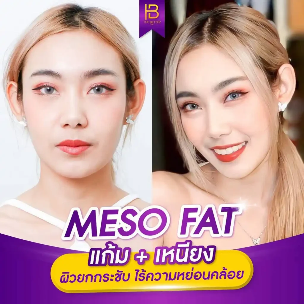 รูปรีวิว 197