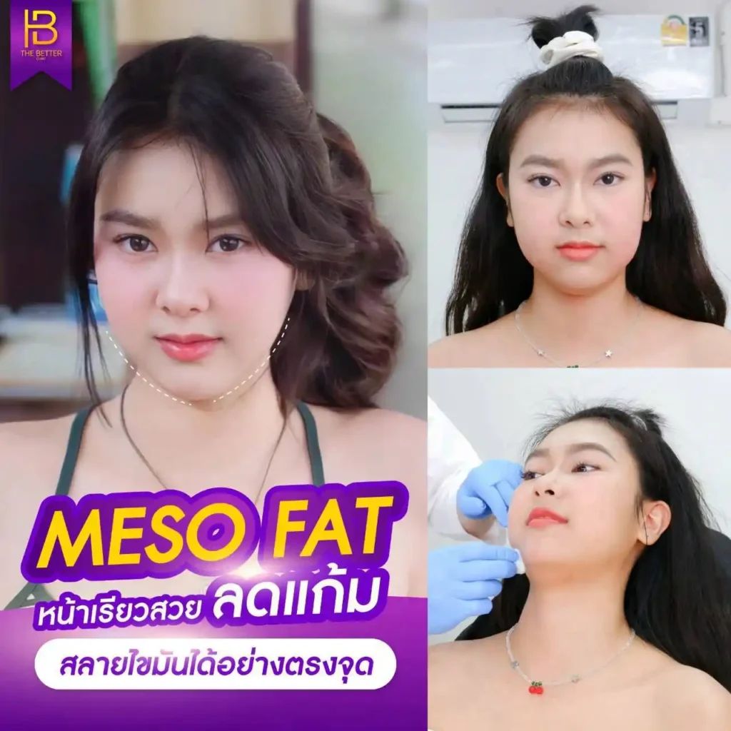 รูปรีวิว 198