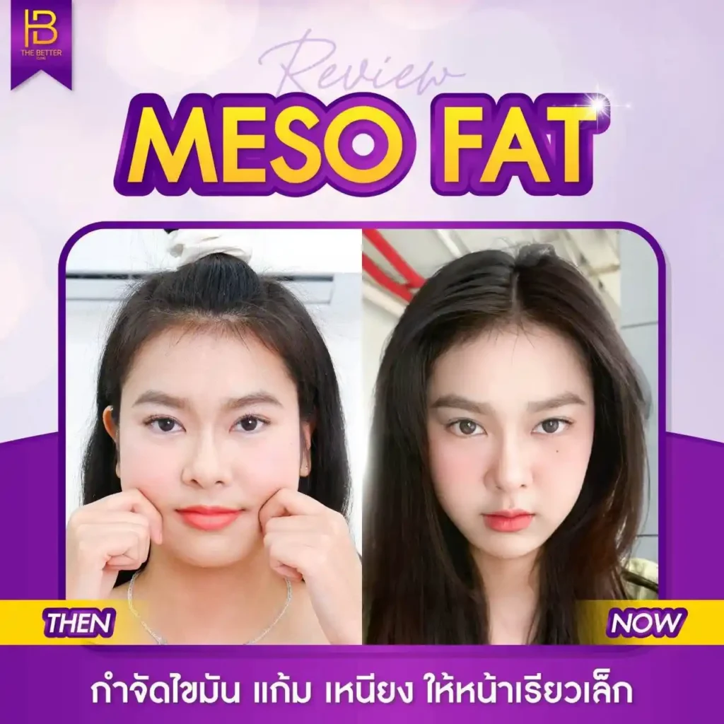 รูปรีวิว 202