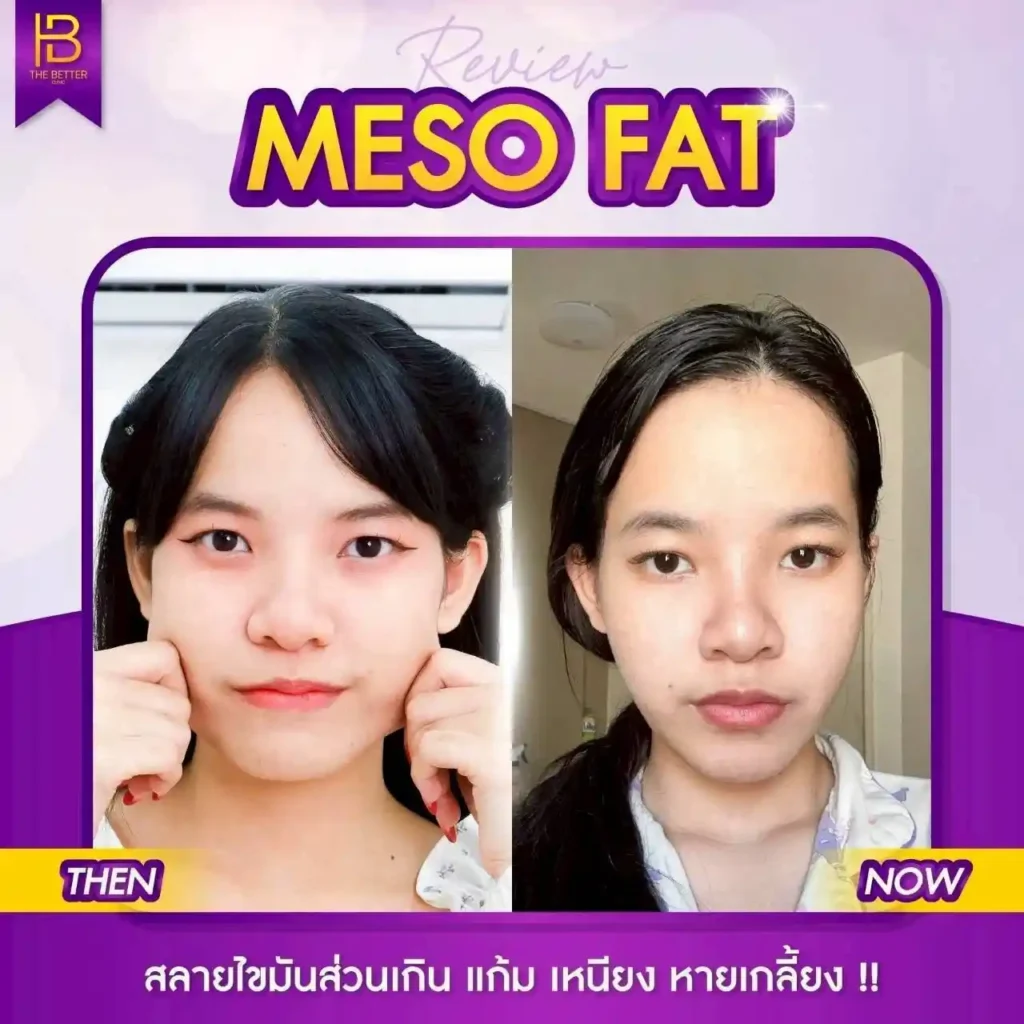 รูปรีวิว 203