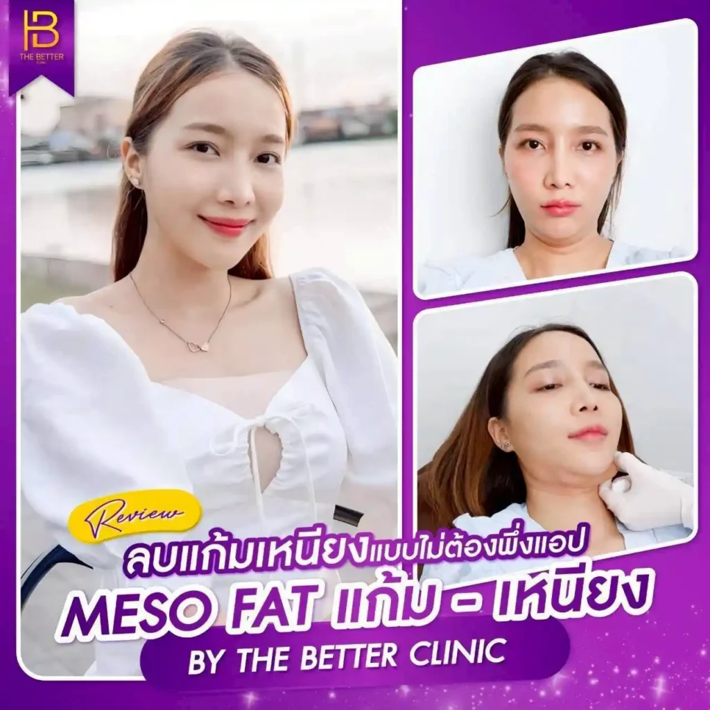 รูปรีวิว 204