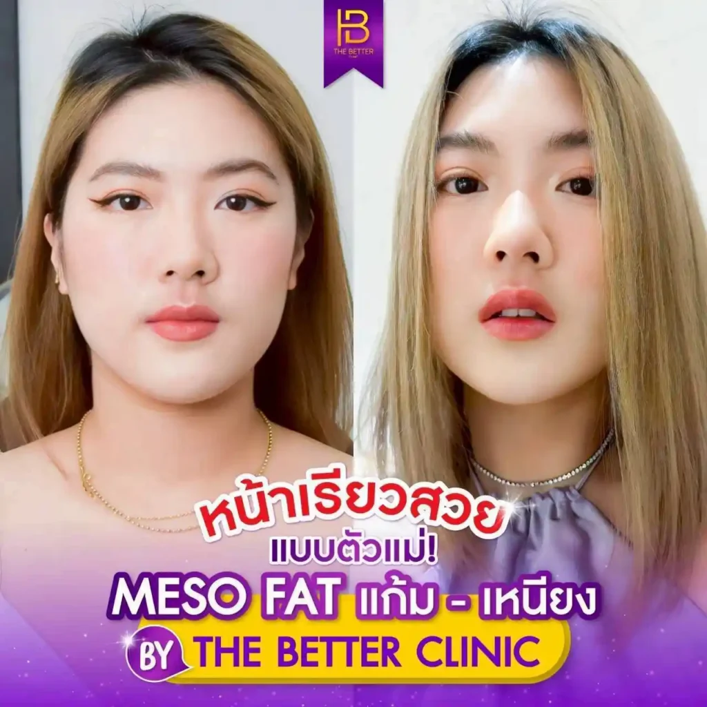 รูปรีวิว 206