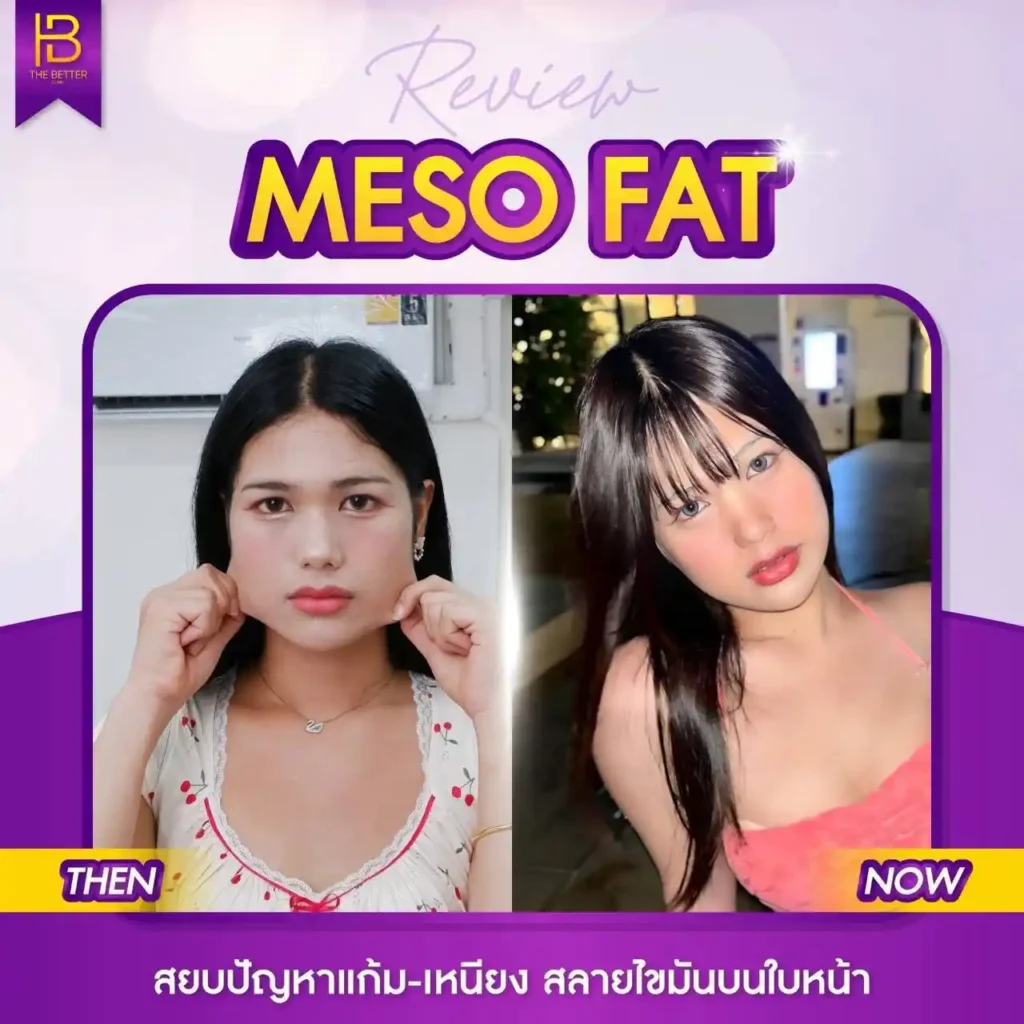 รูปรีวิว 207