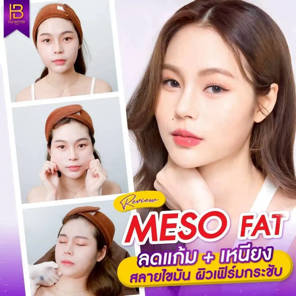 รูปรีวิว 209