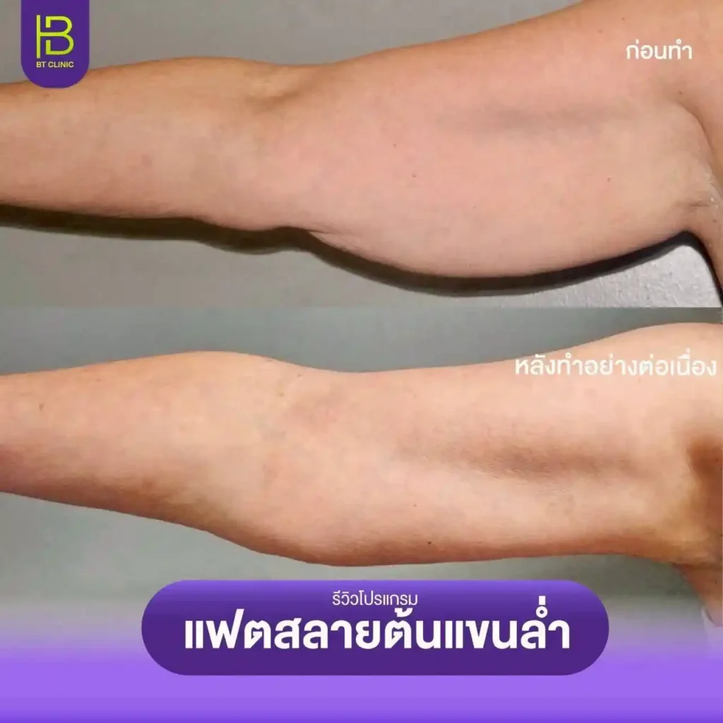 รูปรีวิว 214