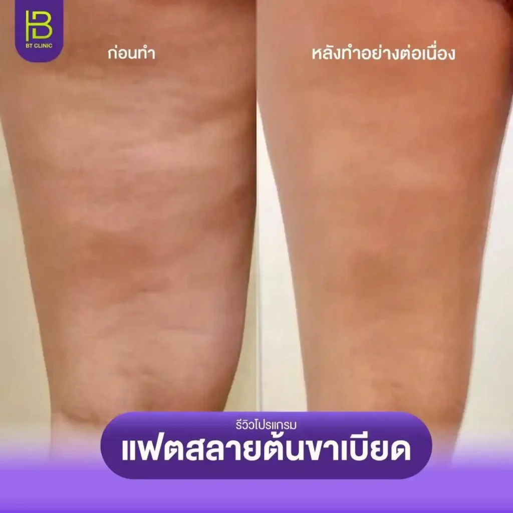 รูปรีวิว 215