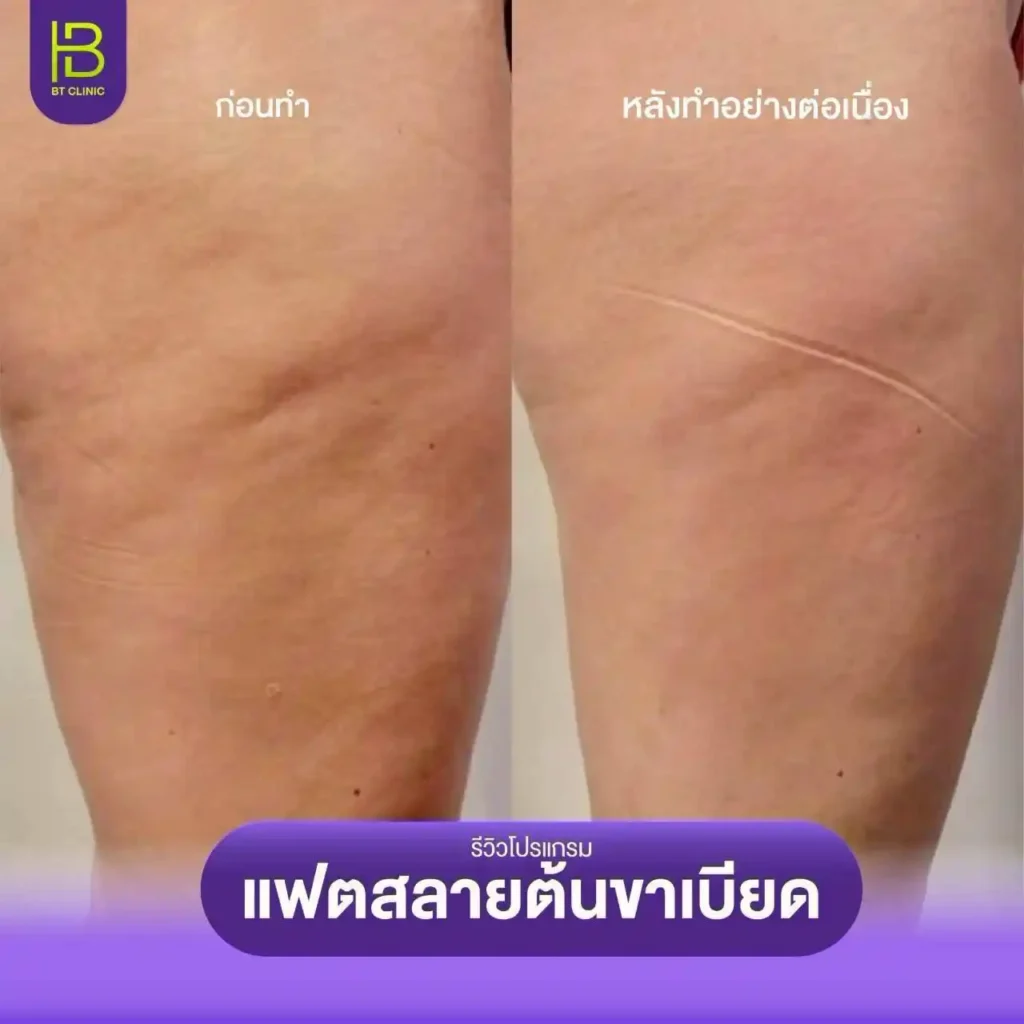 รูปรีวิว 216