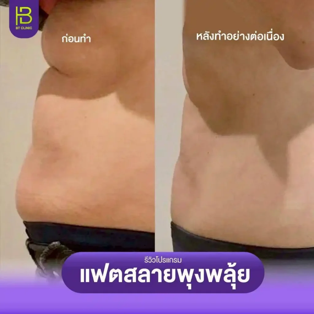 รูปรีวิว 217