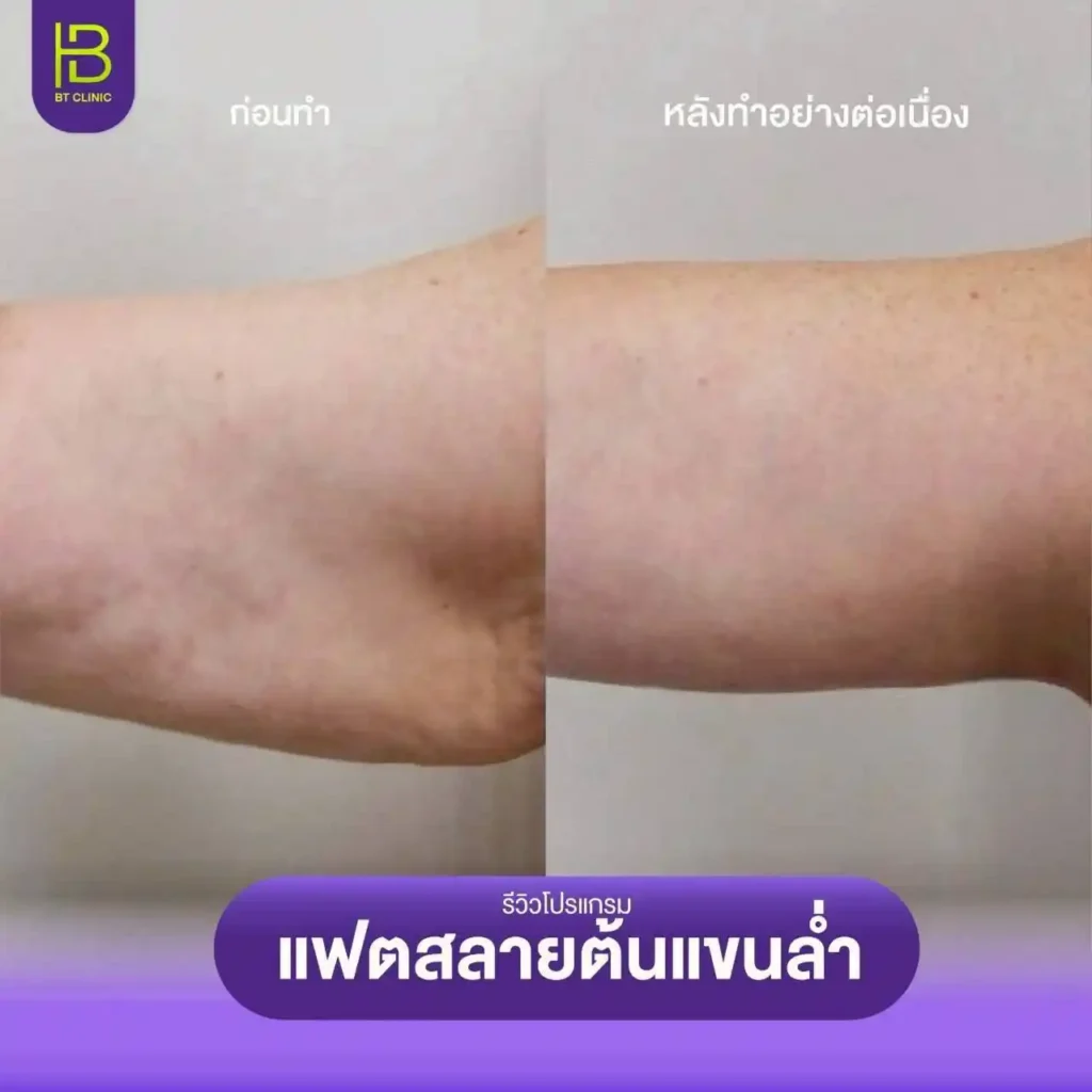 รูปรีวิว 218