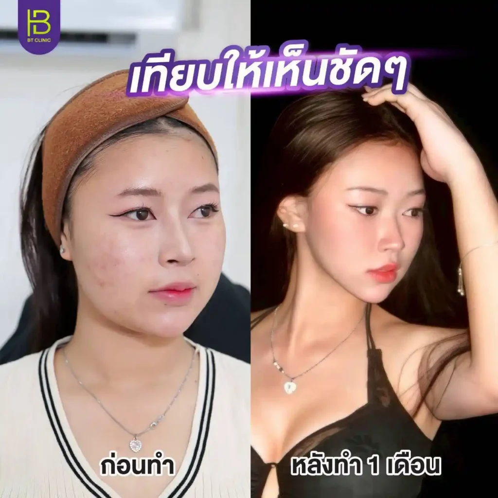 รูปรีวิว 221