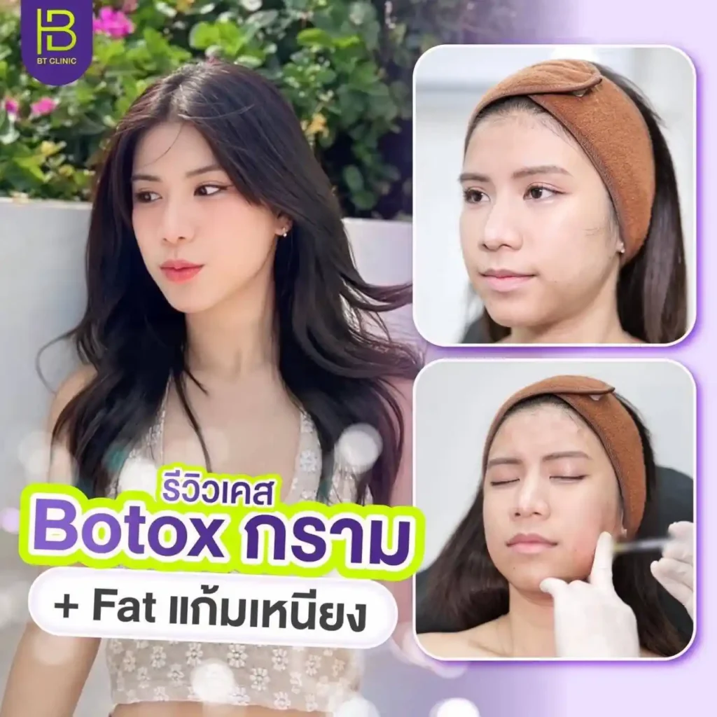 รูปรีวิว 223