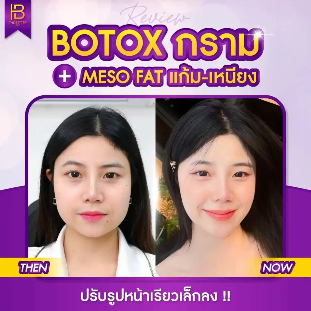 รูปรีวิว 224