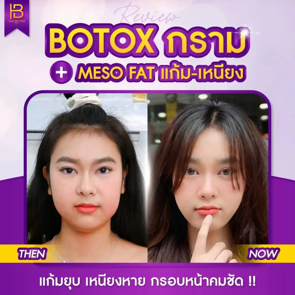 รูปรีวิว 225