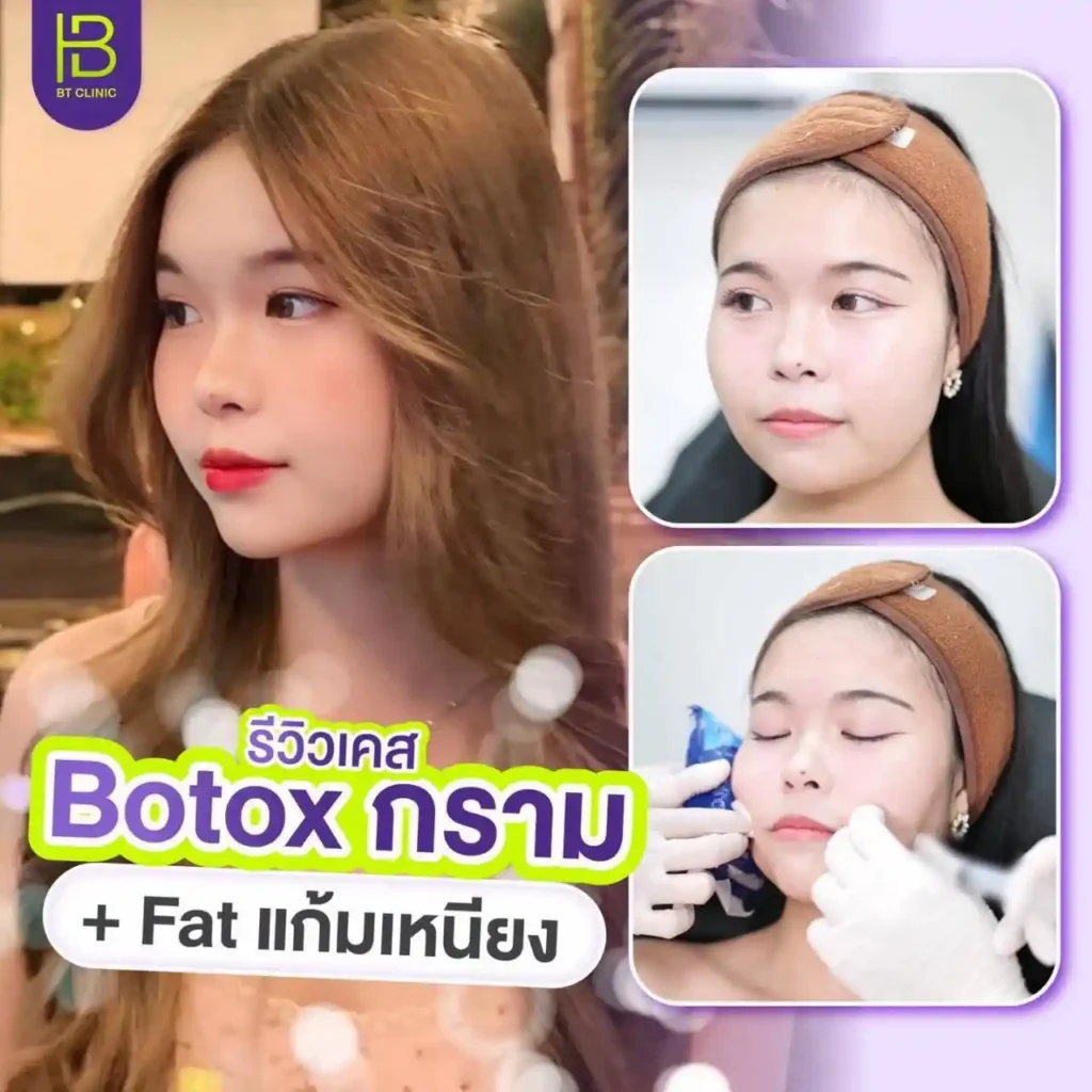 รูปรีวิว 226