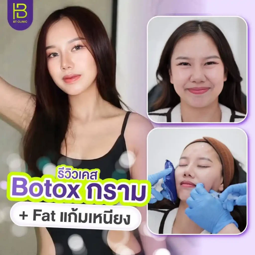 รูปรีวิว 230
