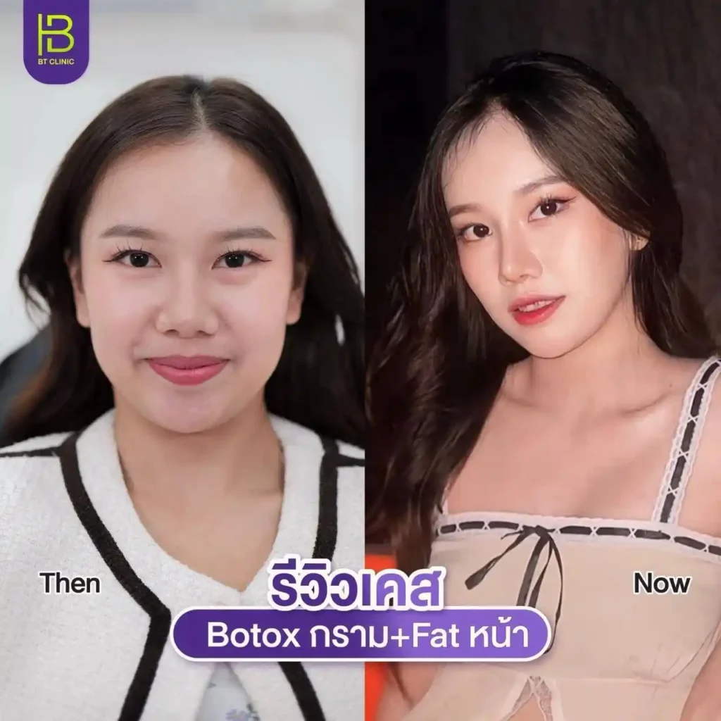 รูปรีวิว 233