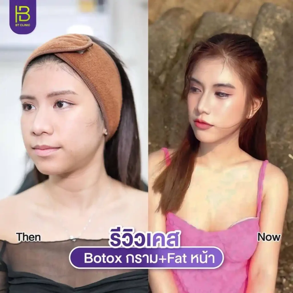 รูปรีวิว 234