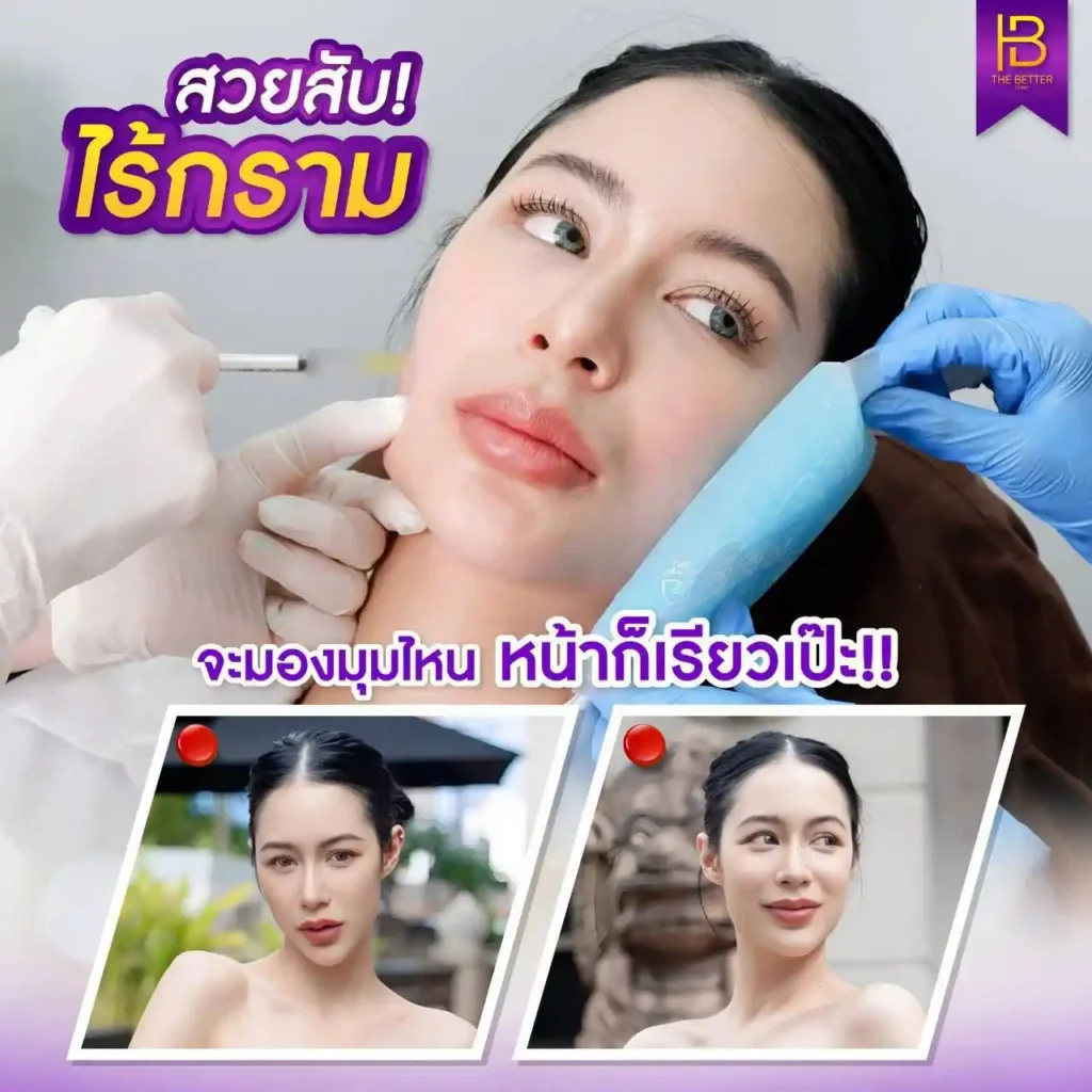 รูปรีวิว 235
