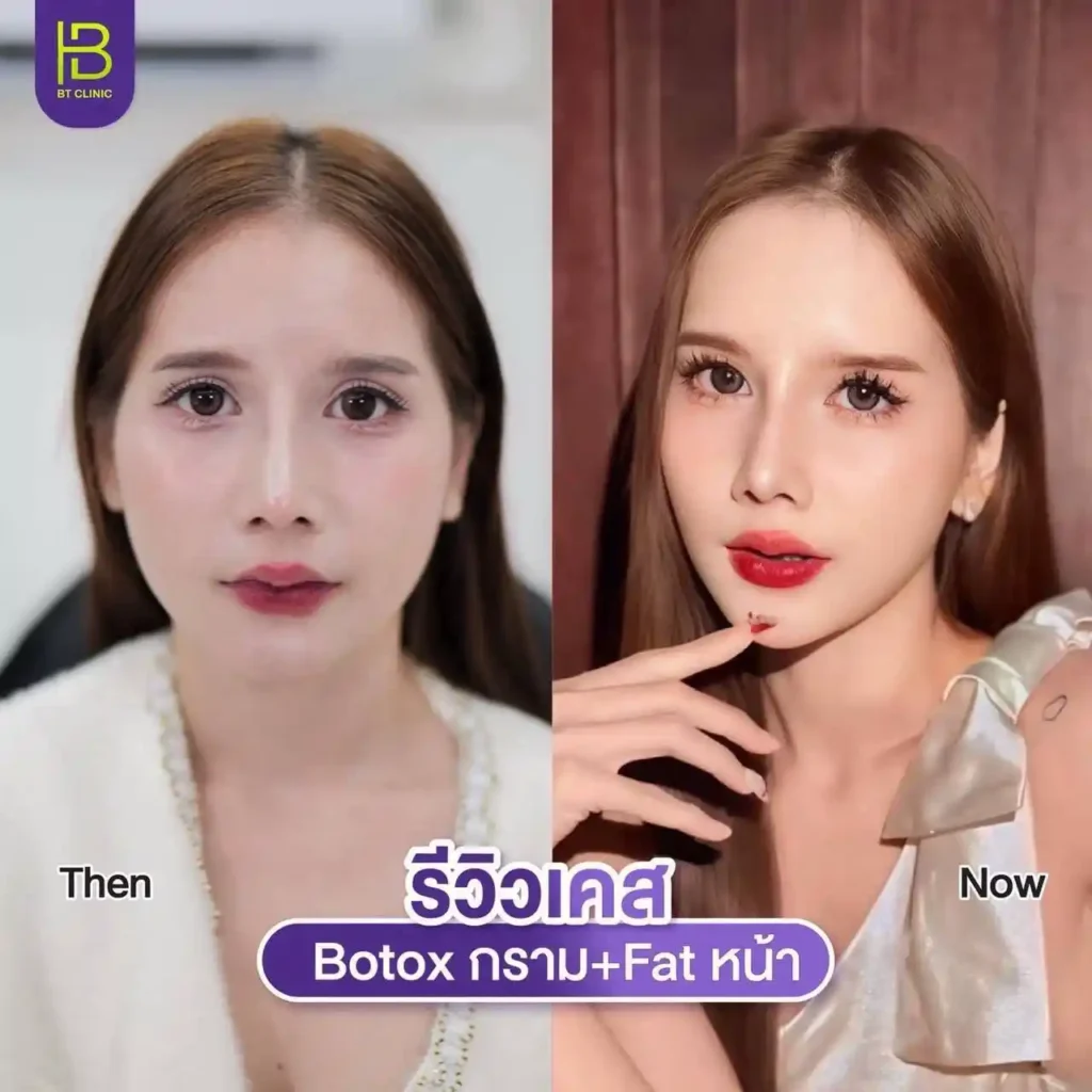 รูปรีวิว 236