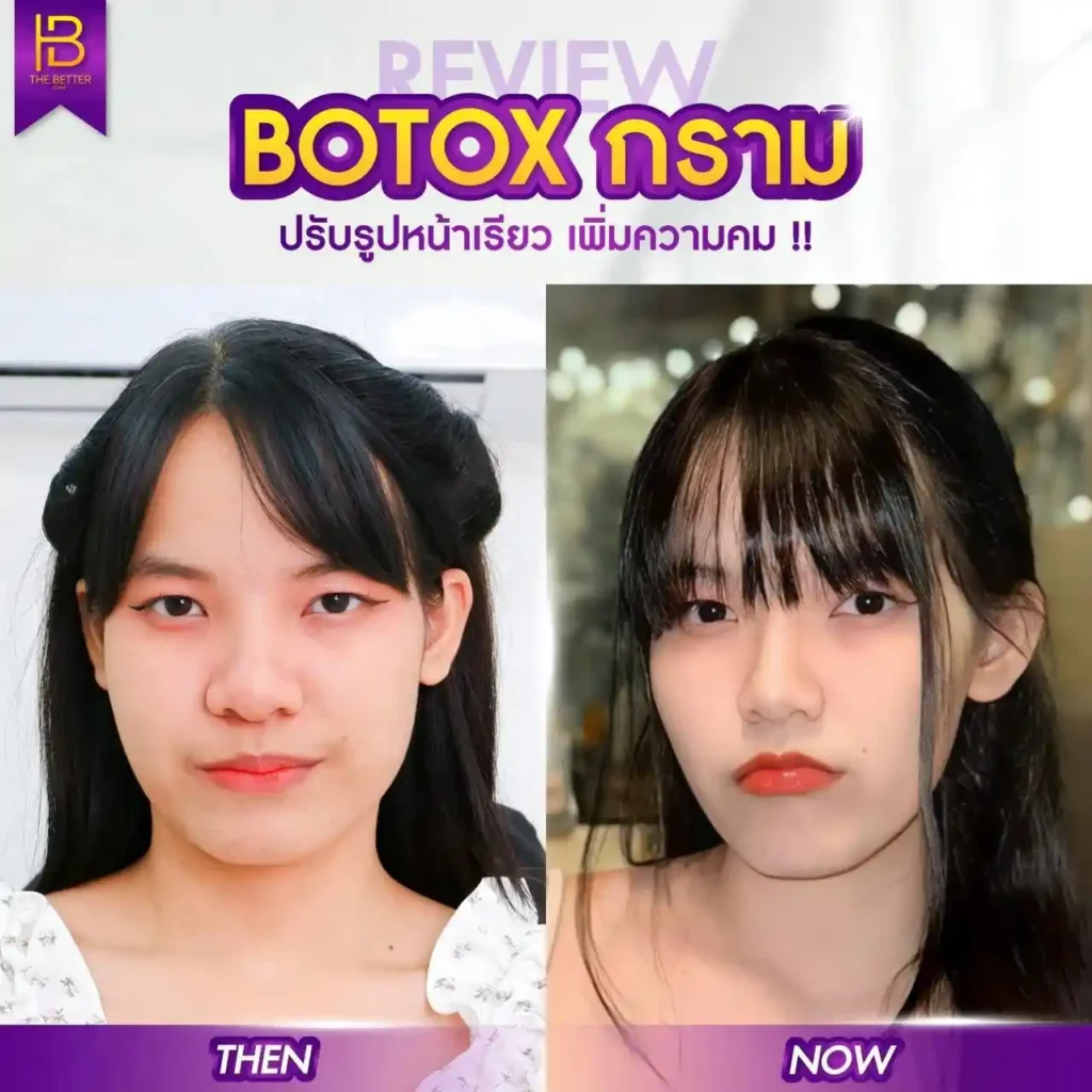 รูปรีวิว 237