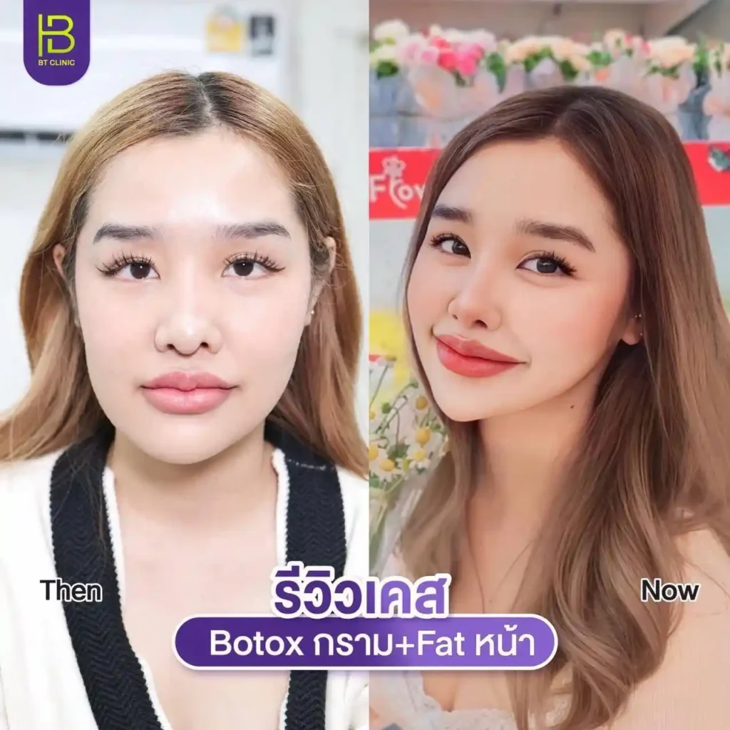 รูปรีวิว 238