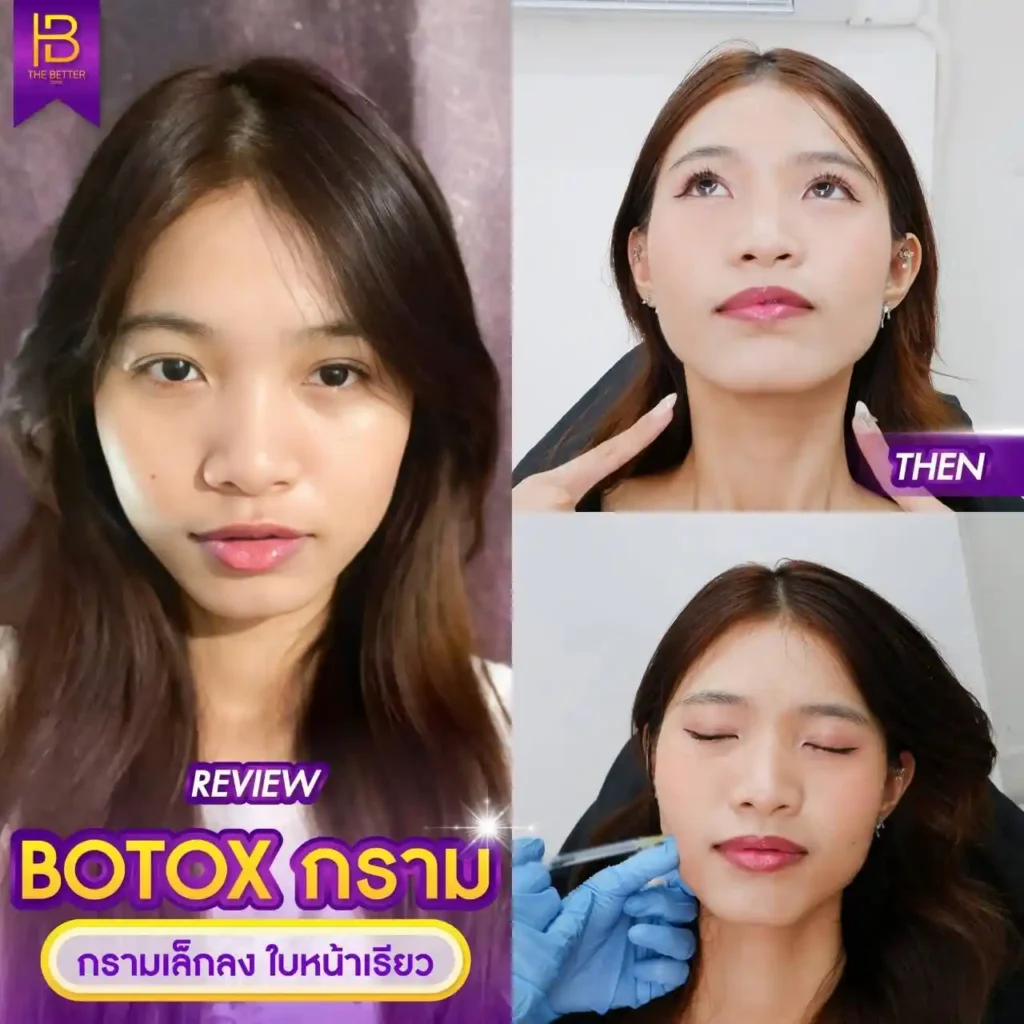 รูปรีวิว 240