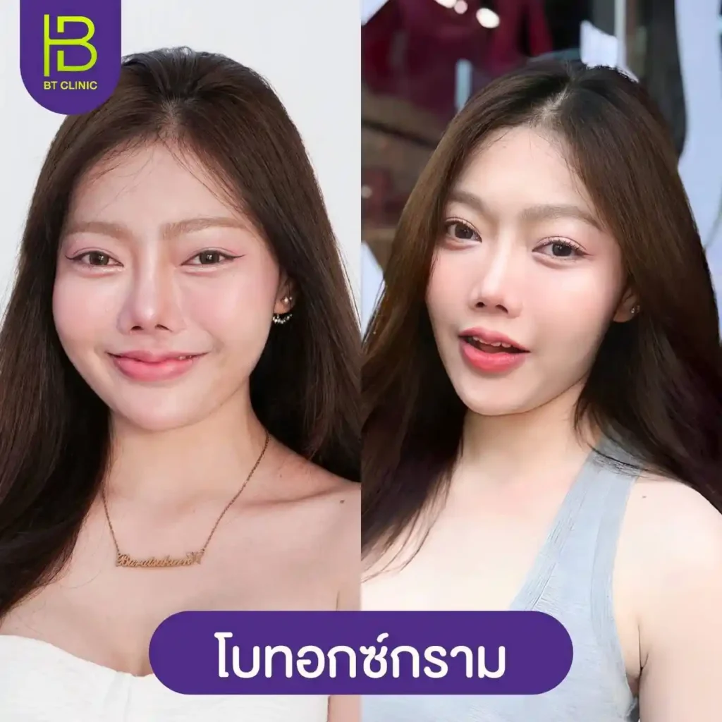 รูปรีวิว 241