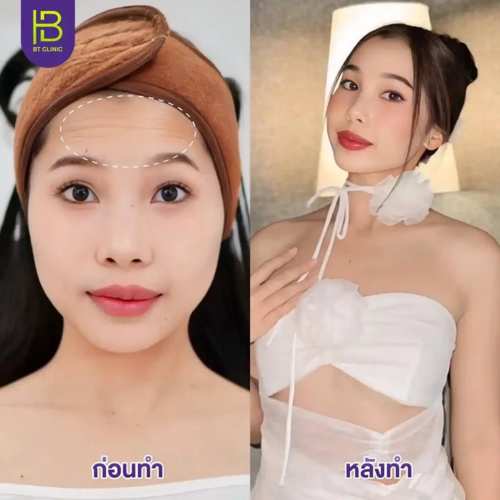 รูปรีวิว 251