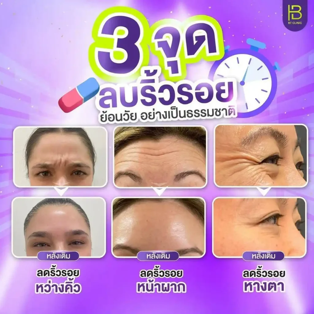 รูปรีวิว 252
