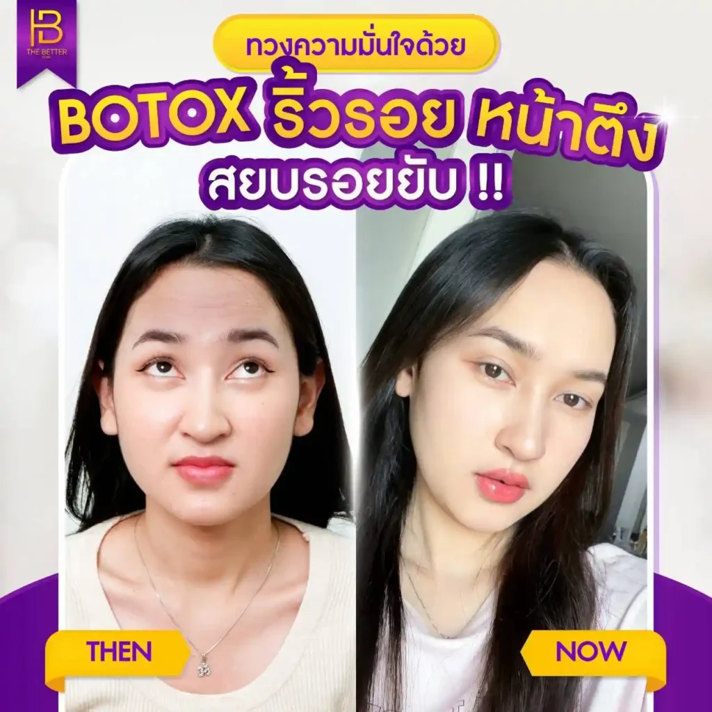รูปรีวิว 254