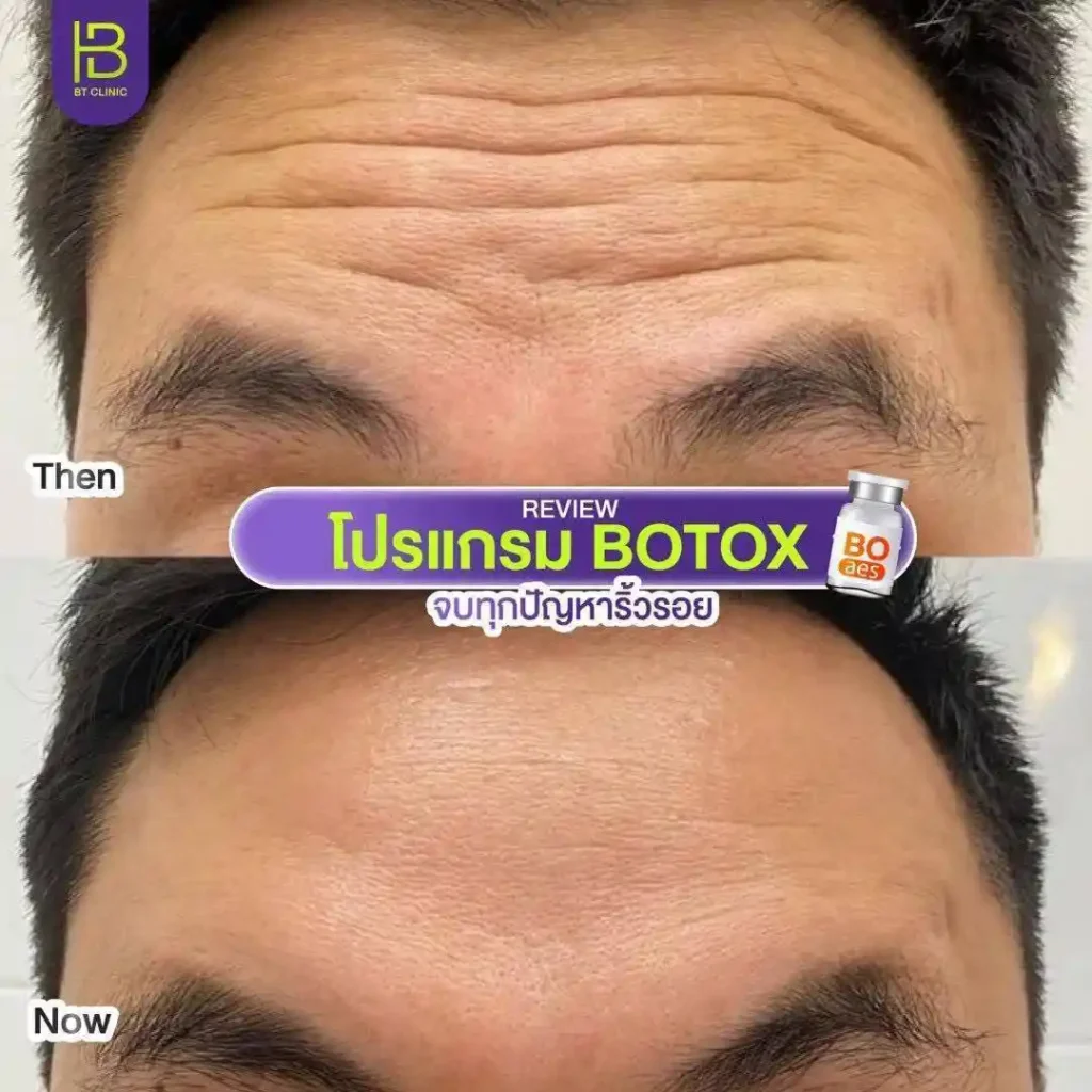 รูปรีวิว 256