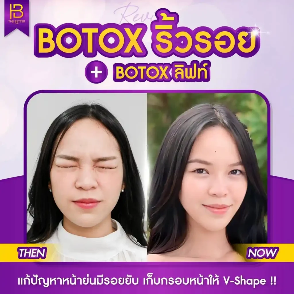 รูปรีวิว 263