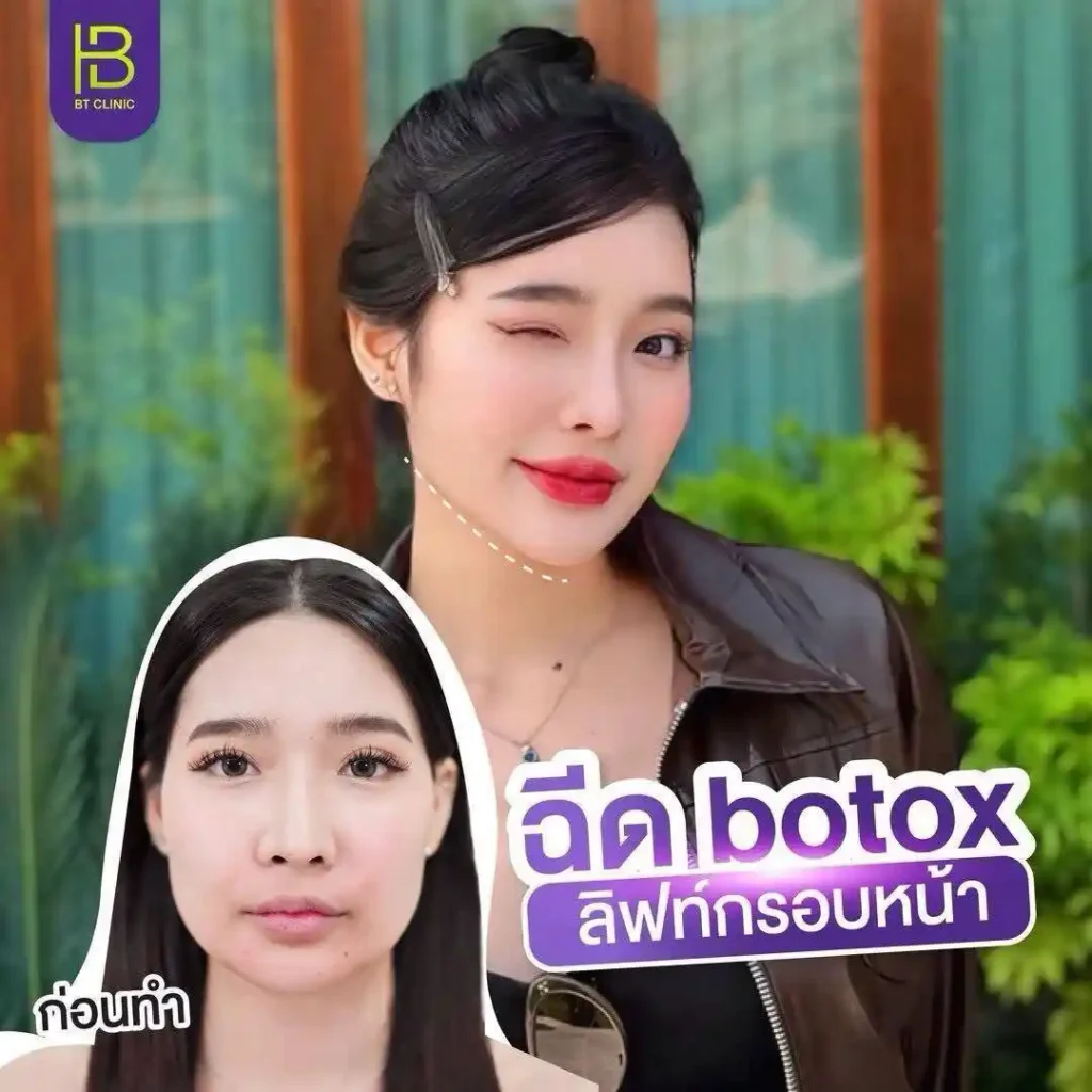 รูปรีวิว 266