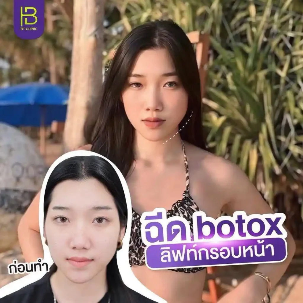 รูปรีวิว 267