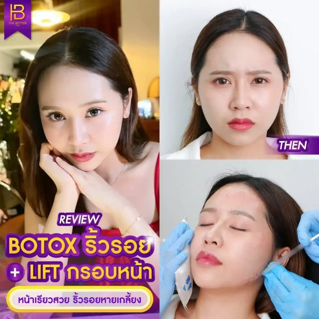 รูปรีวิว 269