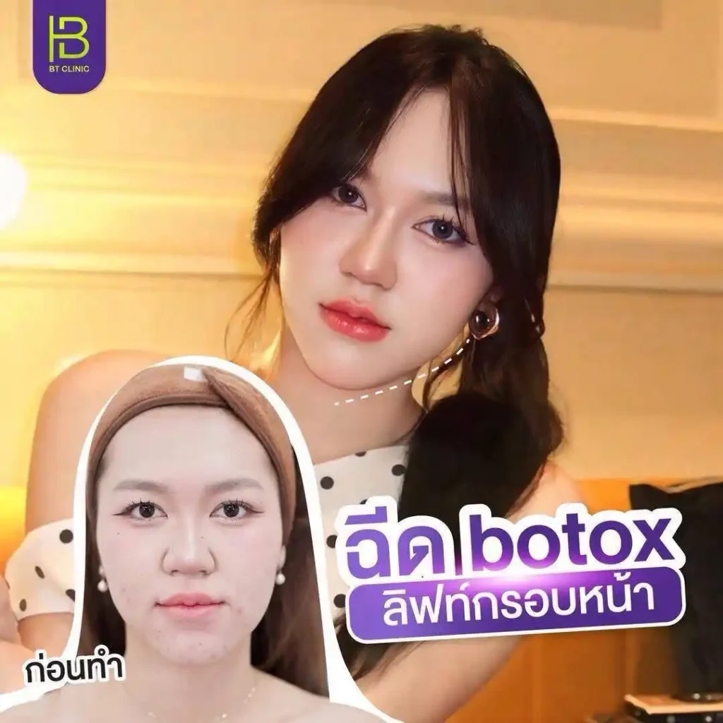รูปรีวิว 271