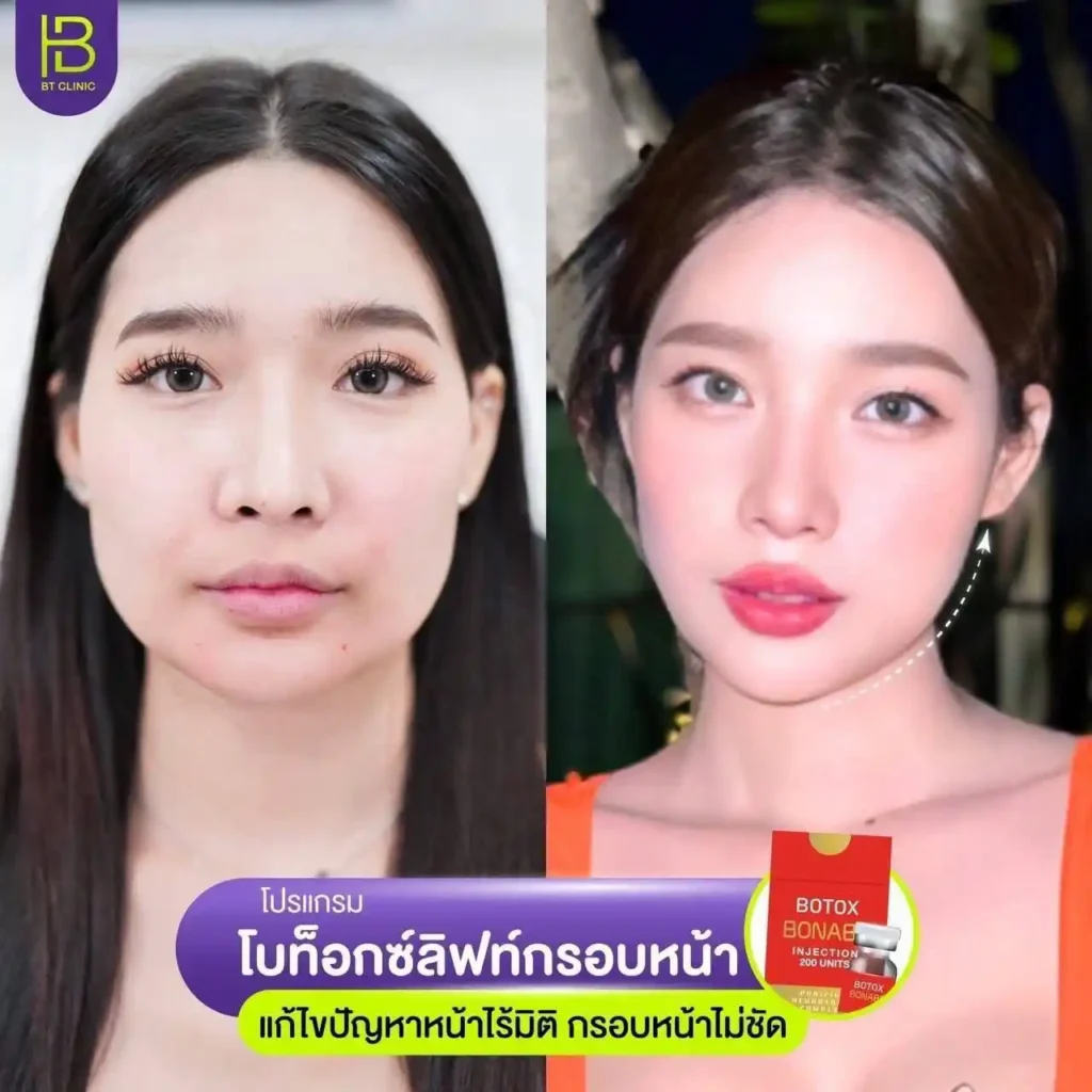 รูปรีวิว 272