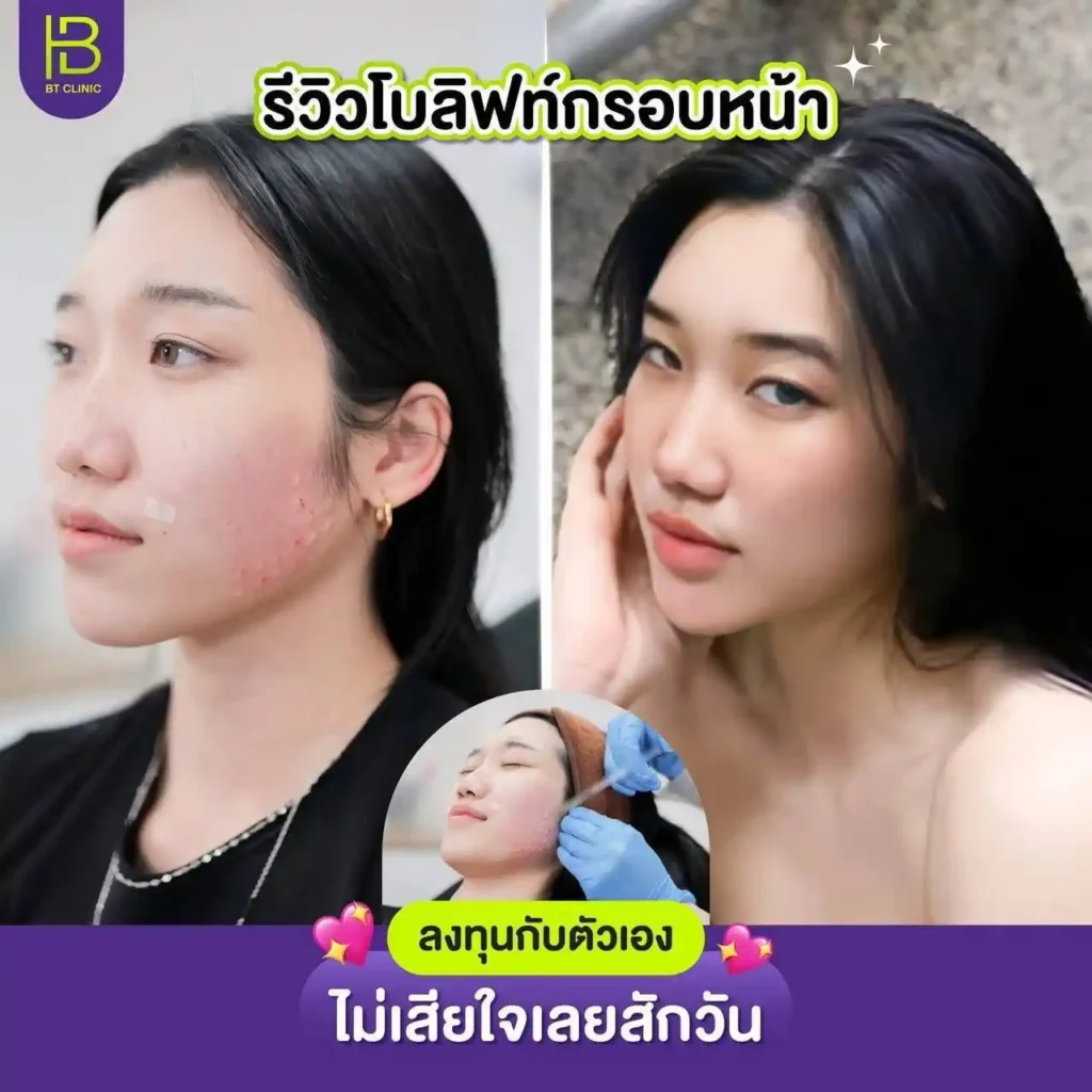 รูปรีวิว 273