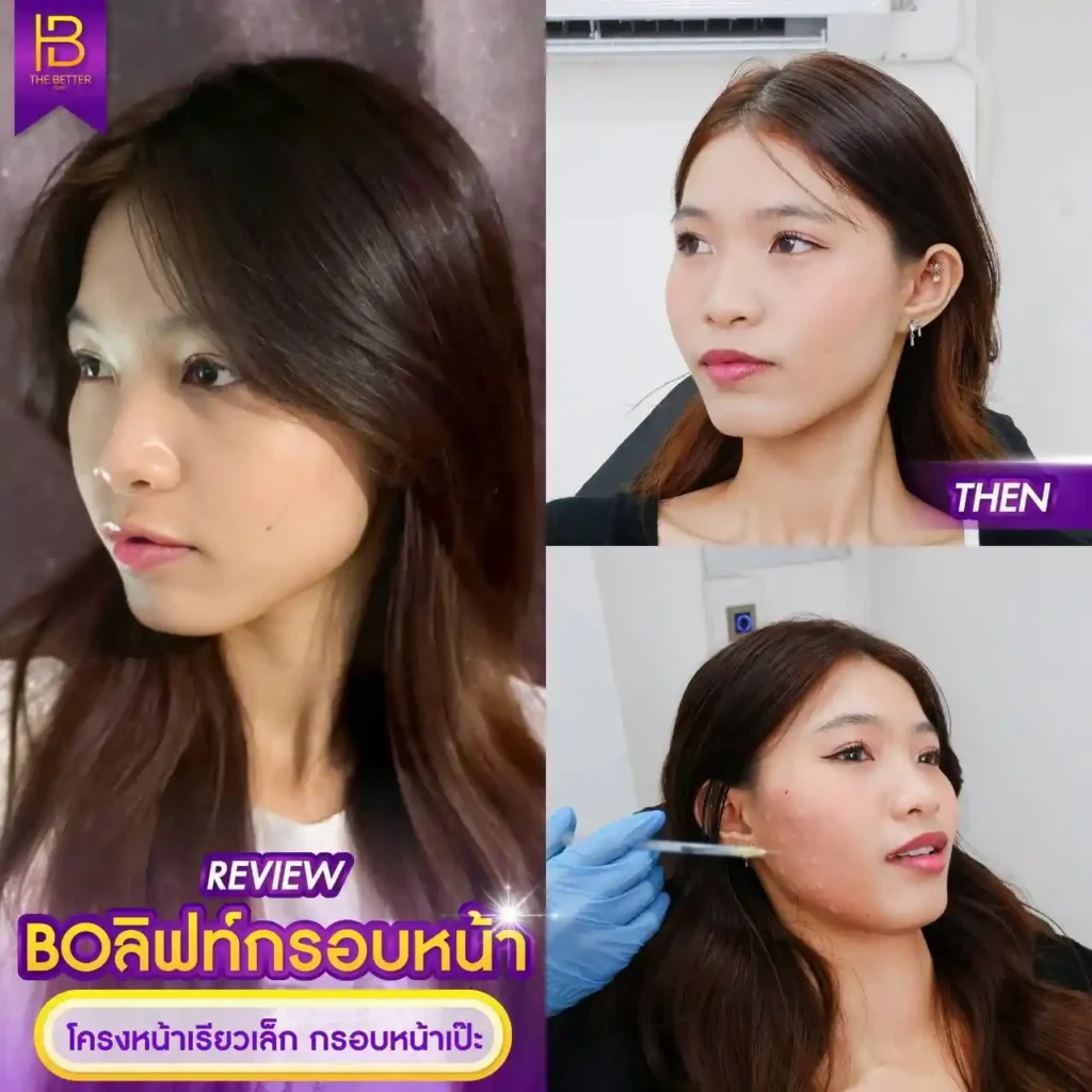 รูปรีวิว 275