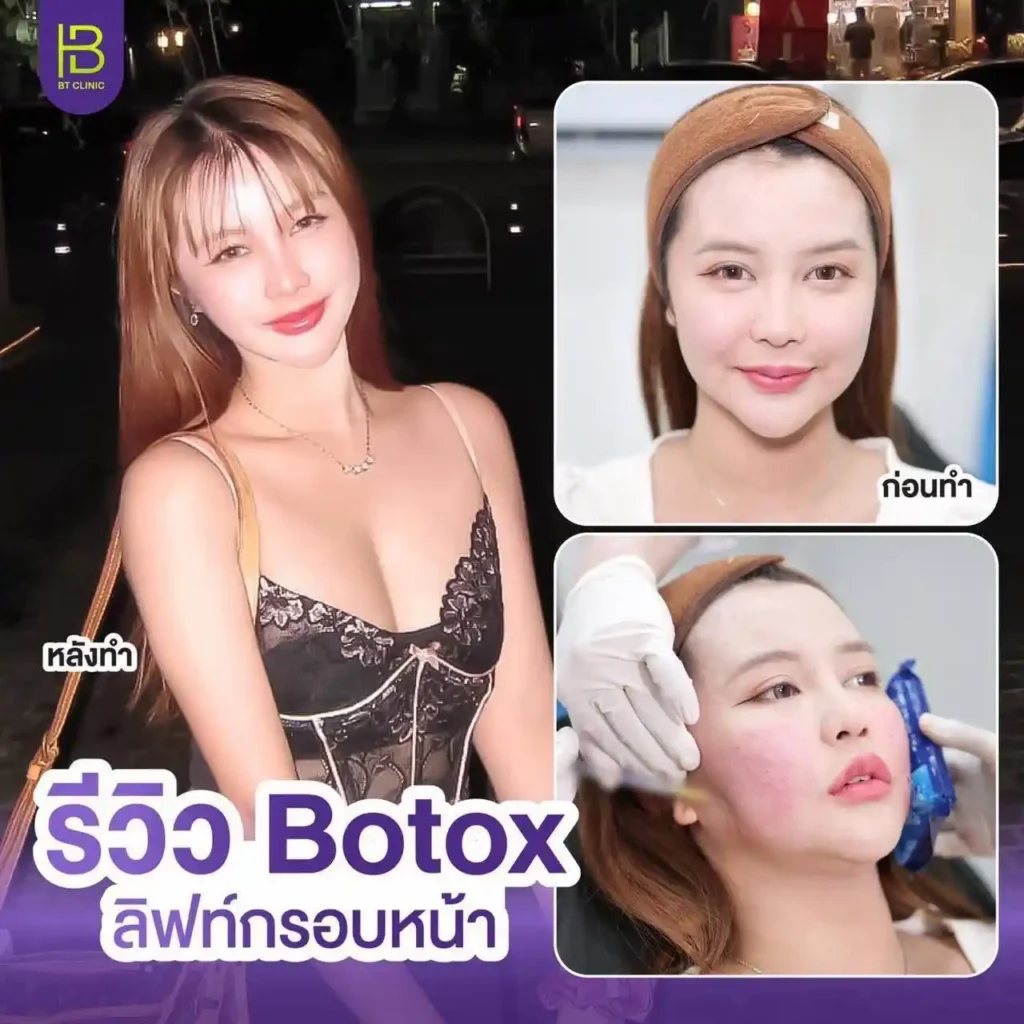 รูปรีวิว 276
