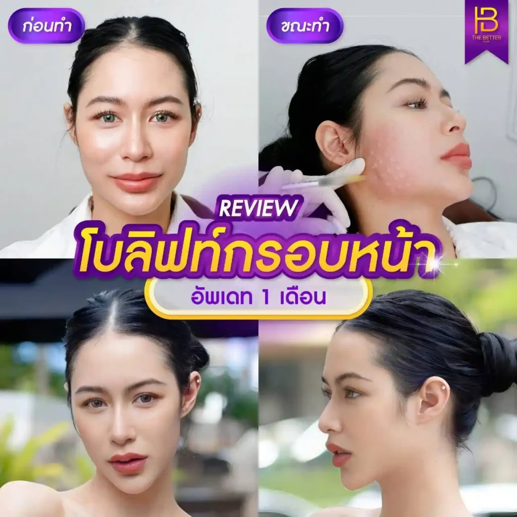 รูปรีวิว 277