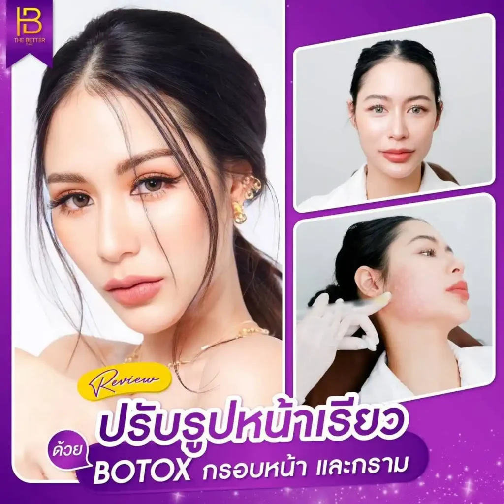 รูปรีวิว 278